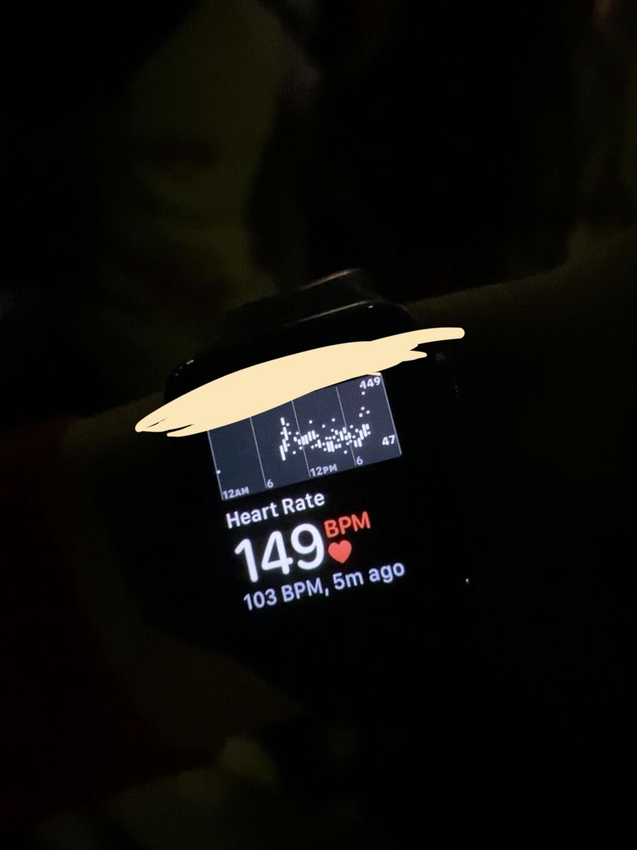 Lyte 🤍🦷 tweet media