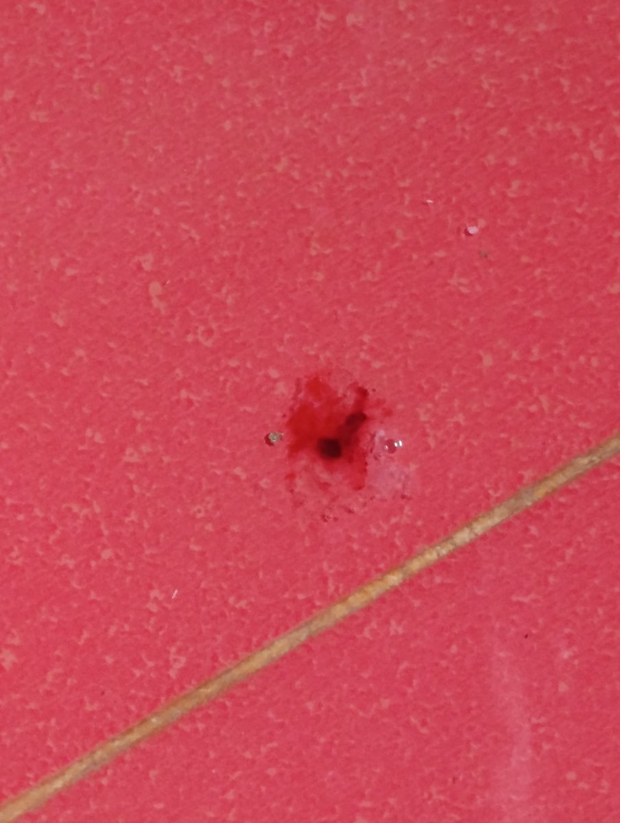 NOOR1870514's tweet photo. Hello friends, I'm very tired. My nose is bleeding due to inflammation and a severe case of the flu. Please donate and help me get urgent treatment to stop the bleeding.https://t.co/UT4E1t2BxZ https://t.co/gOIWvFw99e