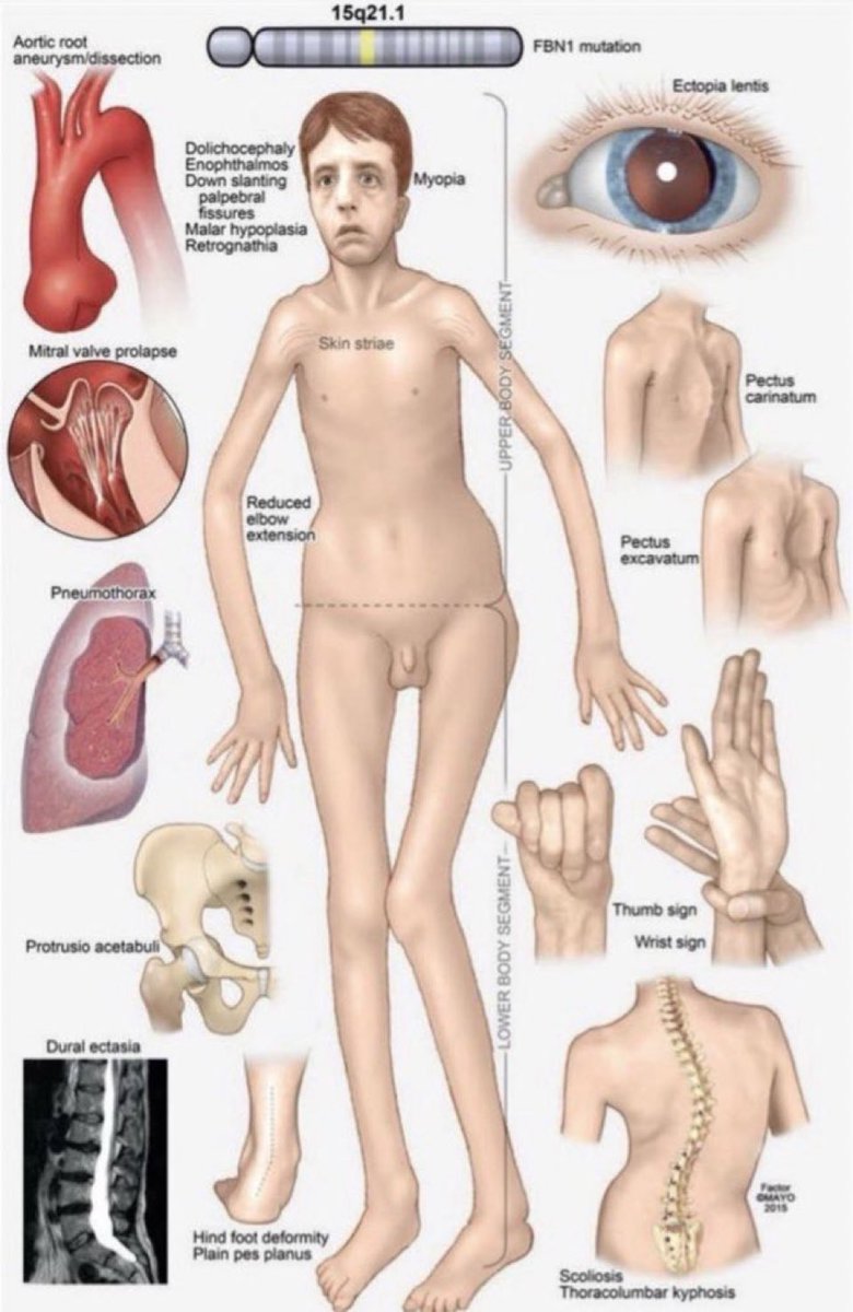 Sly, R. Goomba (PS5@300k) tweet media