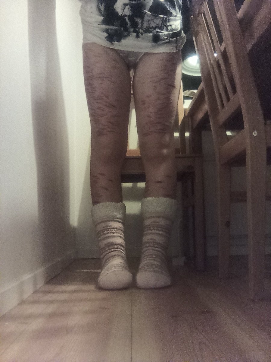 chocolatehurtstopurge tweet media