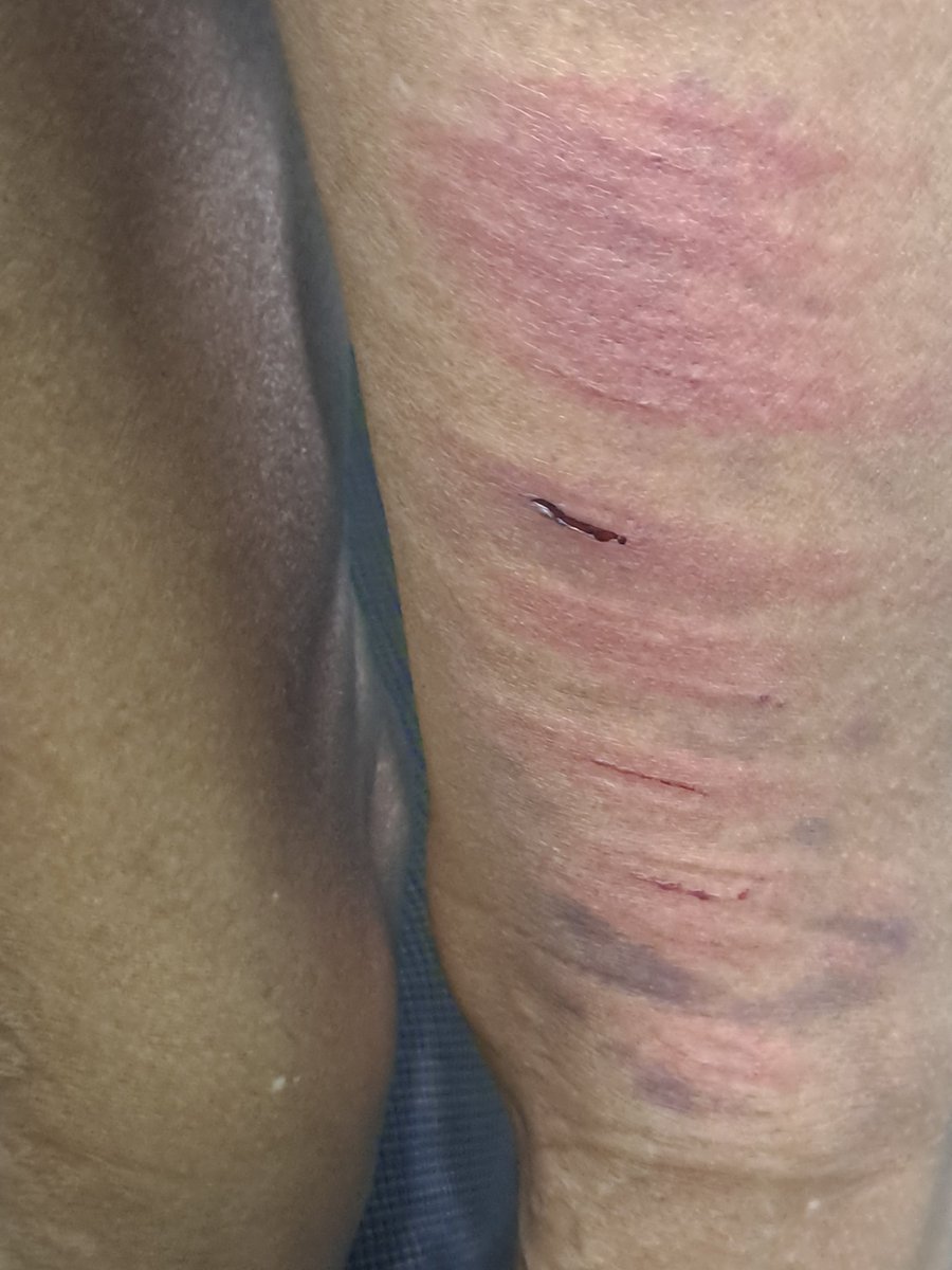 MaungMaung tweet media