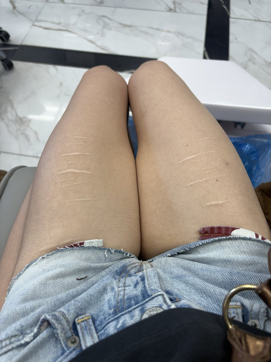 prettyskinny tweet media