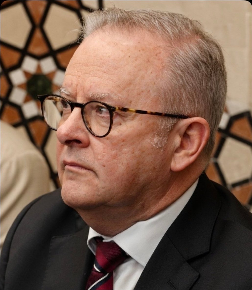 Chicken Little, The "Racist" Chook. tweet media