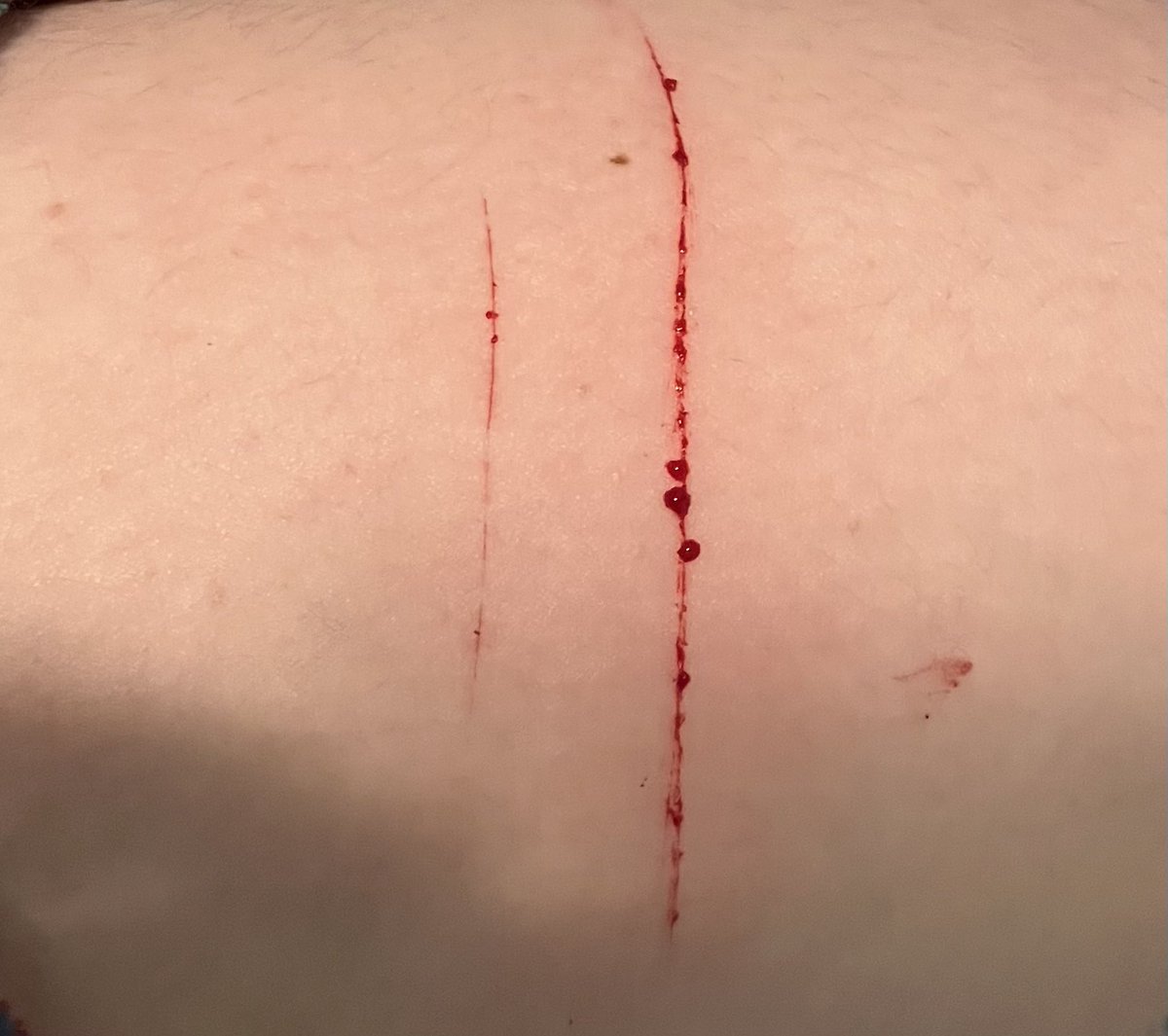 🪷Cinnamon of slittwt🧸 tweet media