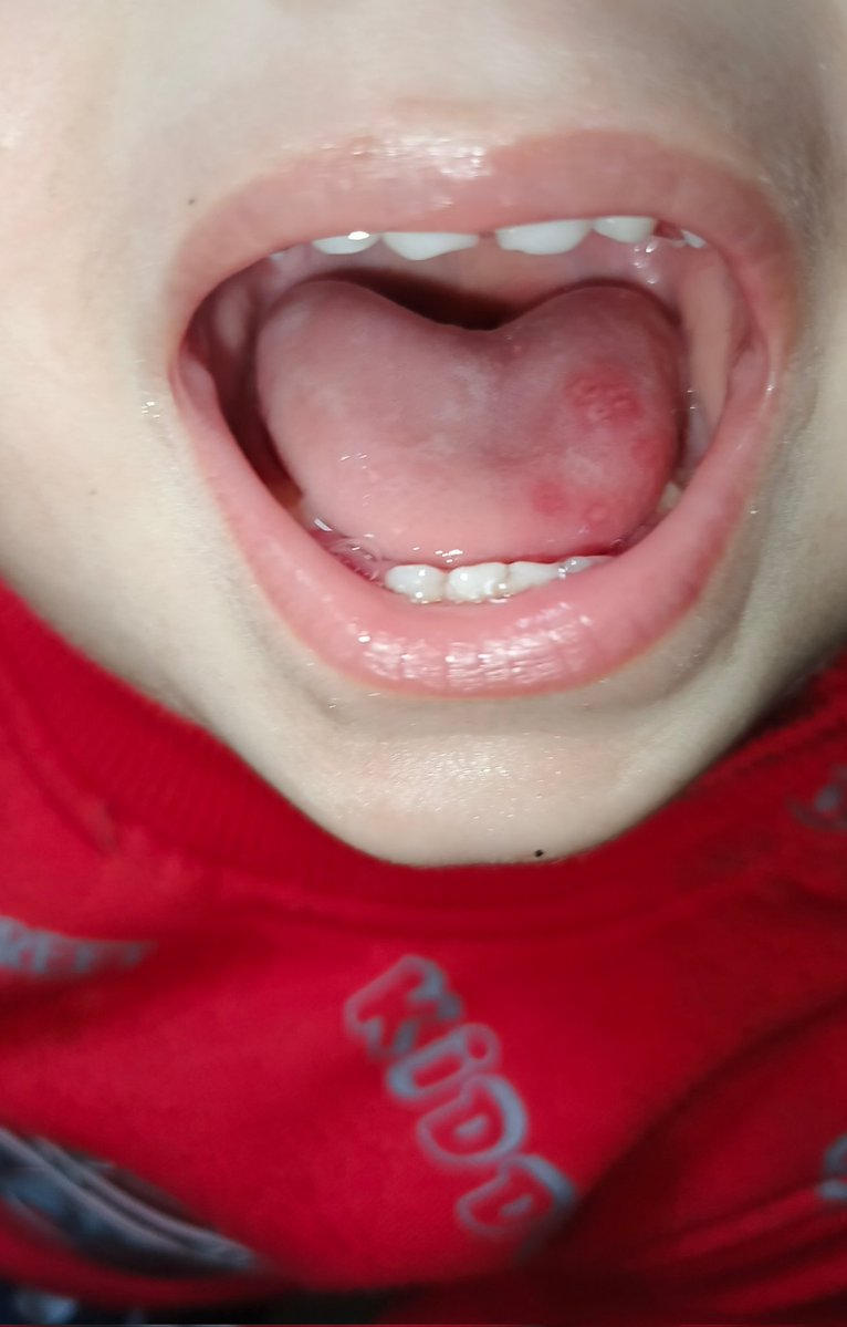 Mohanad from Gaza 🇵🇸 tweet media