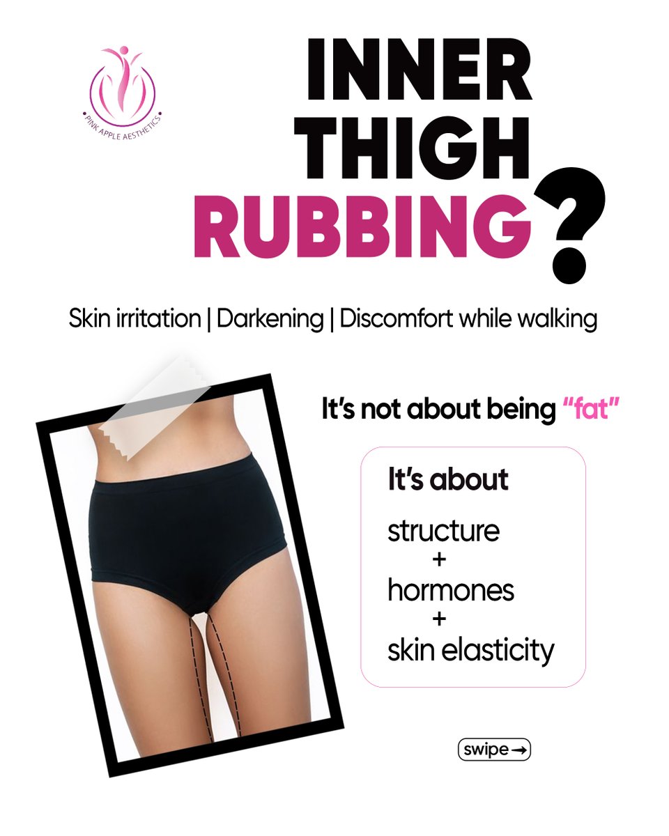 PinkyAesthetics's tweet photo. Because the real goal? Harmony—not unrealistic standards. 💖
Thinking about enhancing your natural shape? Start with the right information.
📍 Pink Apple Aesthetics
📞 Book your consultation today
#BodyContouring #ThighFat #InnerThigh #PinkAppleAesthetics #bangalore https://t.co/t8HB72rwWC