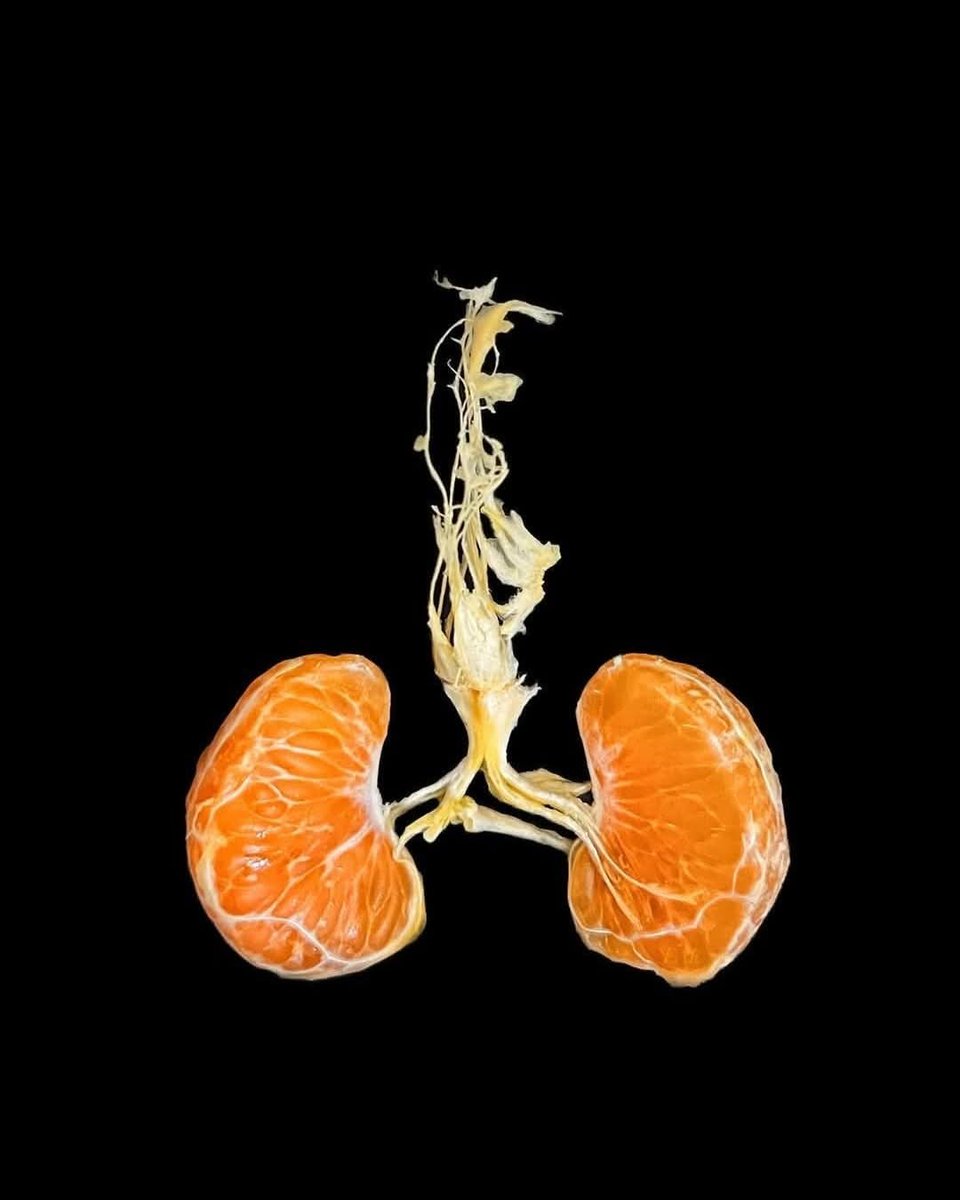 Bon dia! <a href="/ulls_lluents/">Ulls lluents</a>