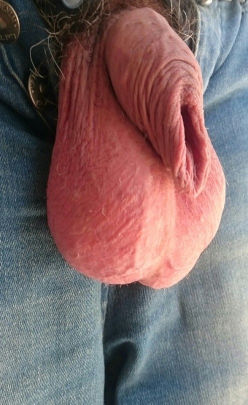 transscrotal tweet media