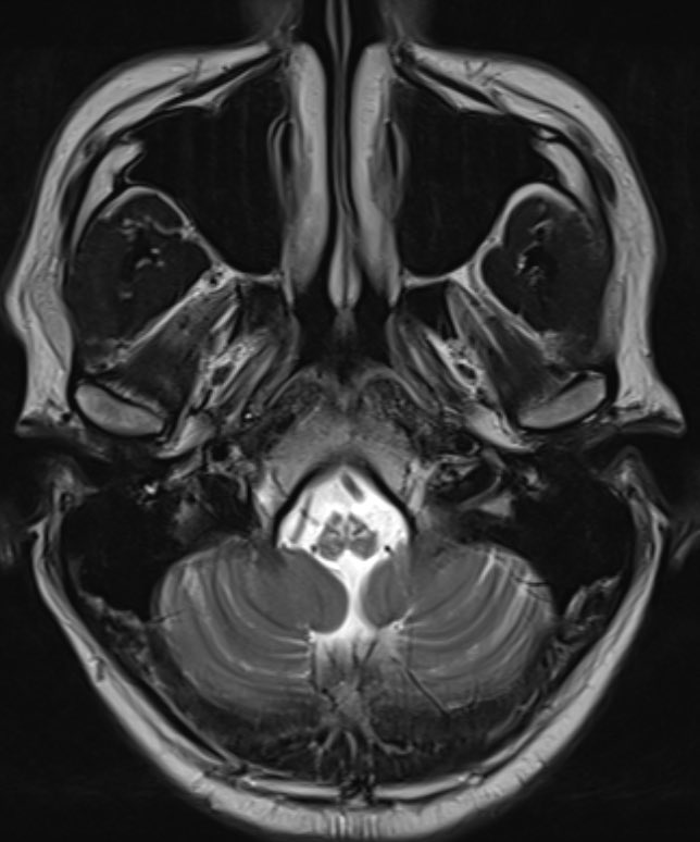 Neurophilia tweet media