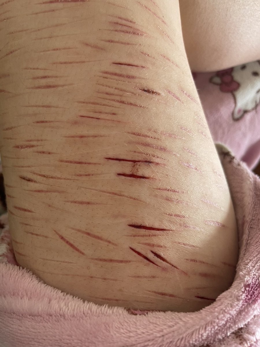 thomyorke of shedtwt 🐾 tweet media