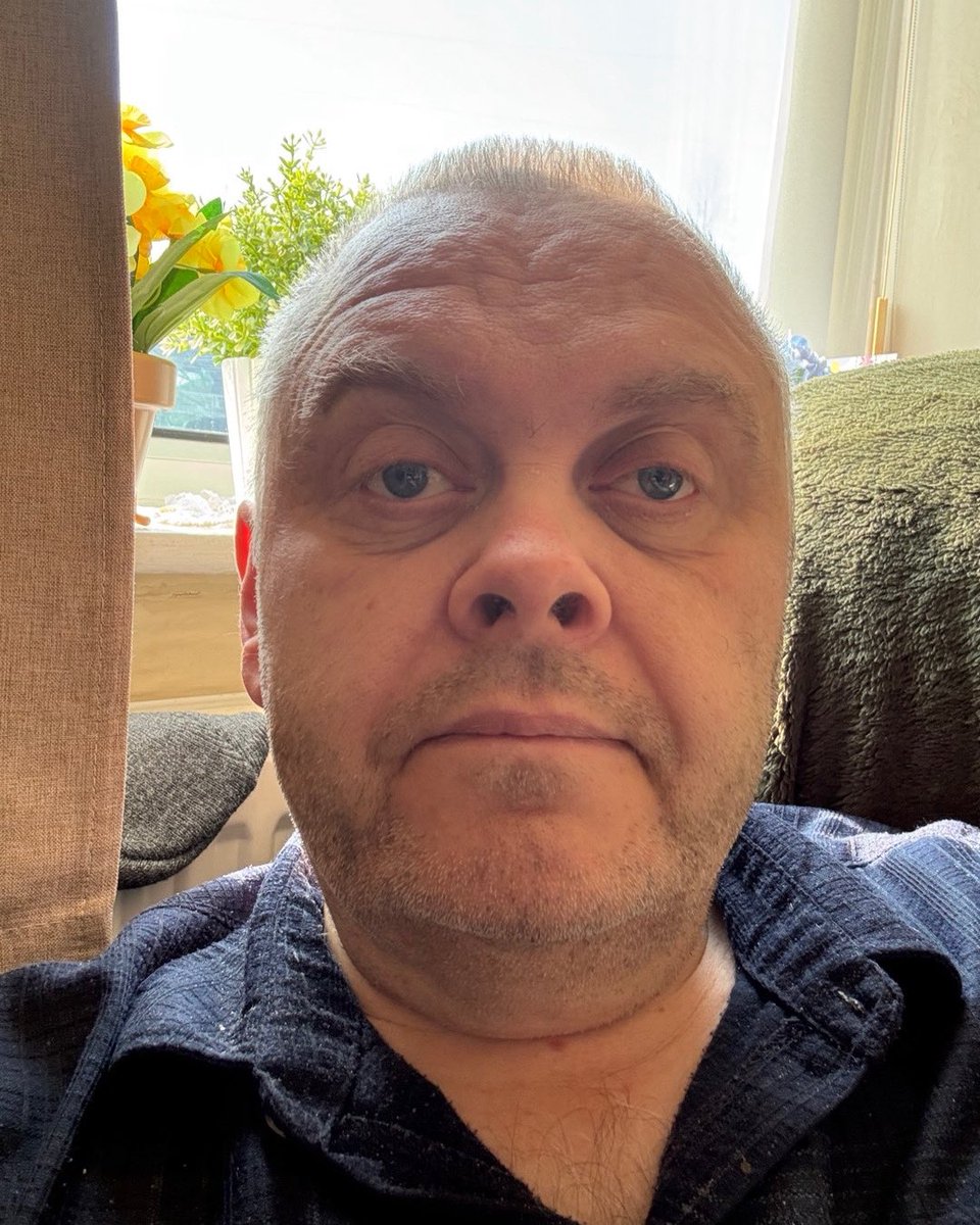 Shaved beard off was itching like crazy