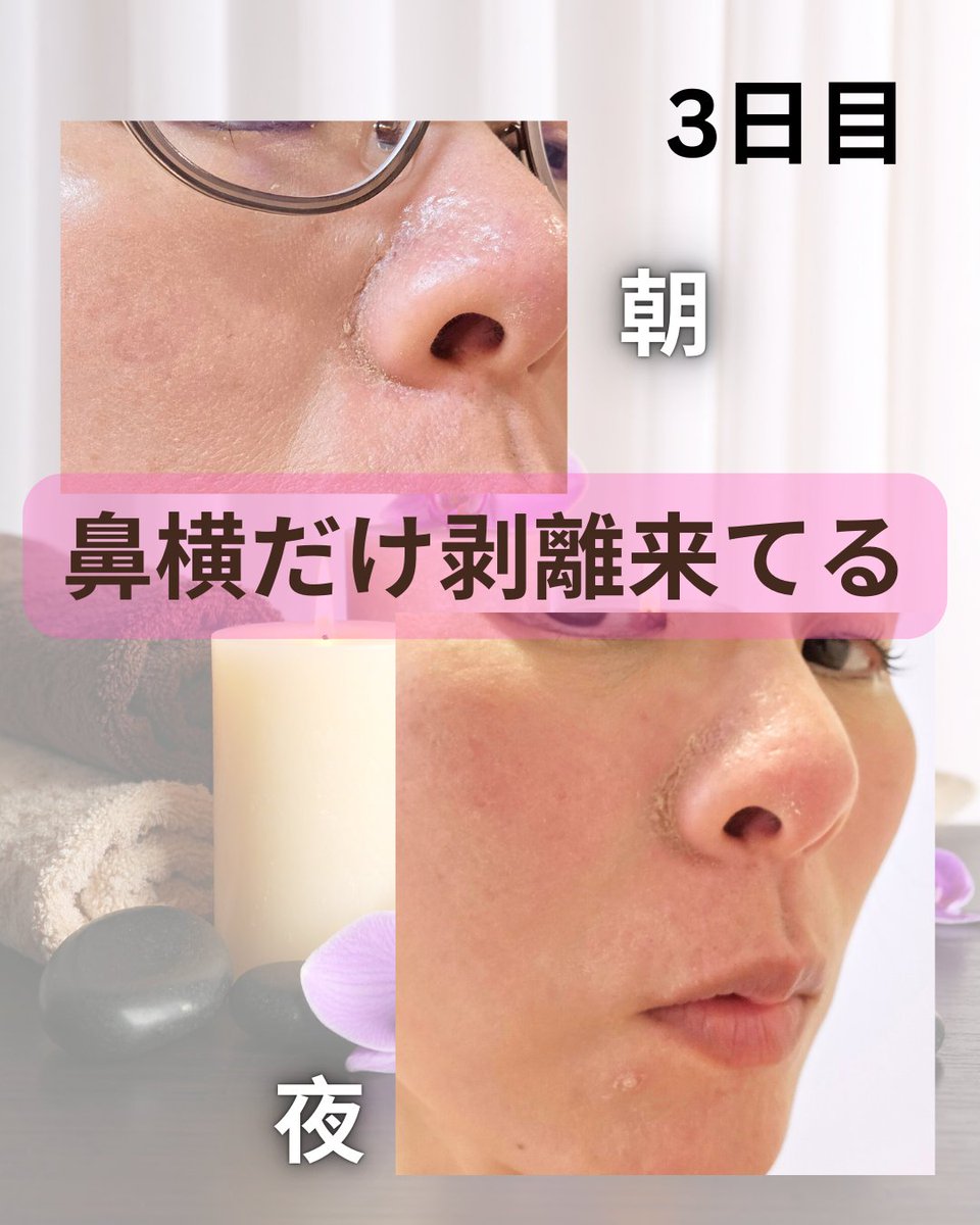 ローちゃん tweet media