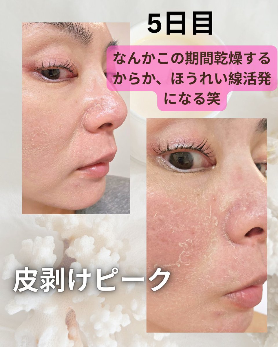 ローちゃん tweet media