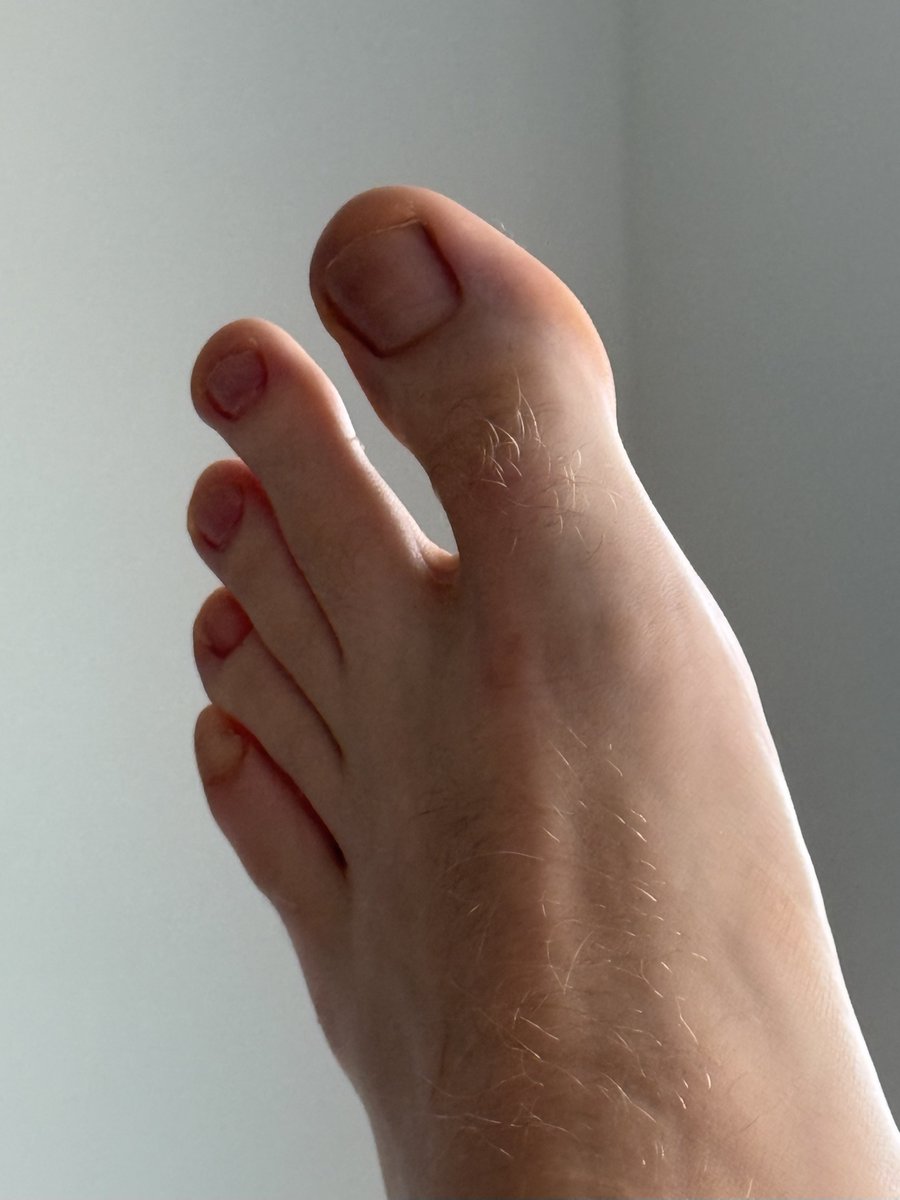 Daniel | the best toes 🐾 tweet media