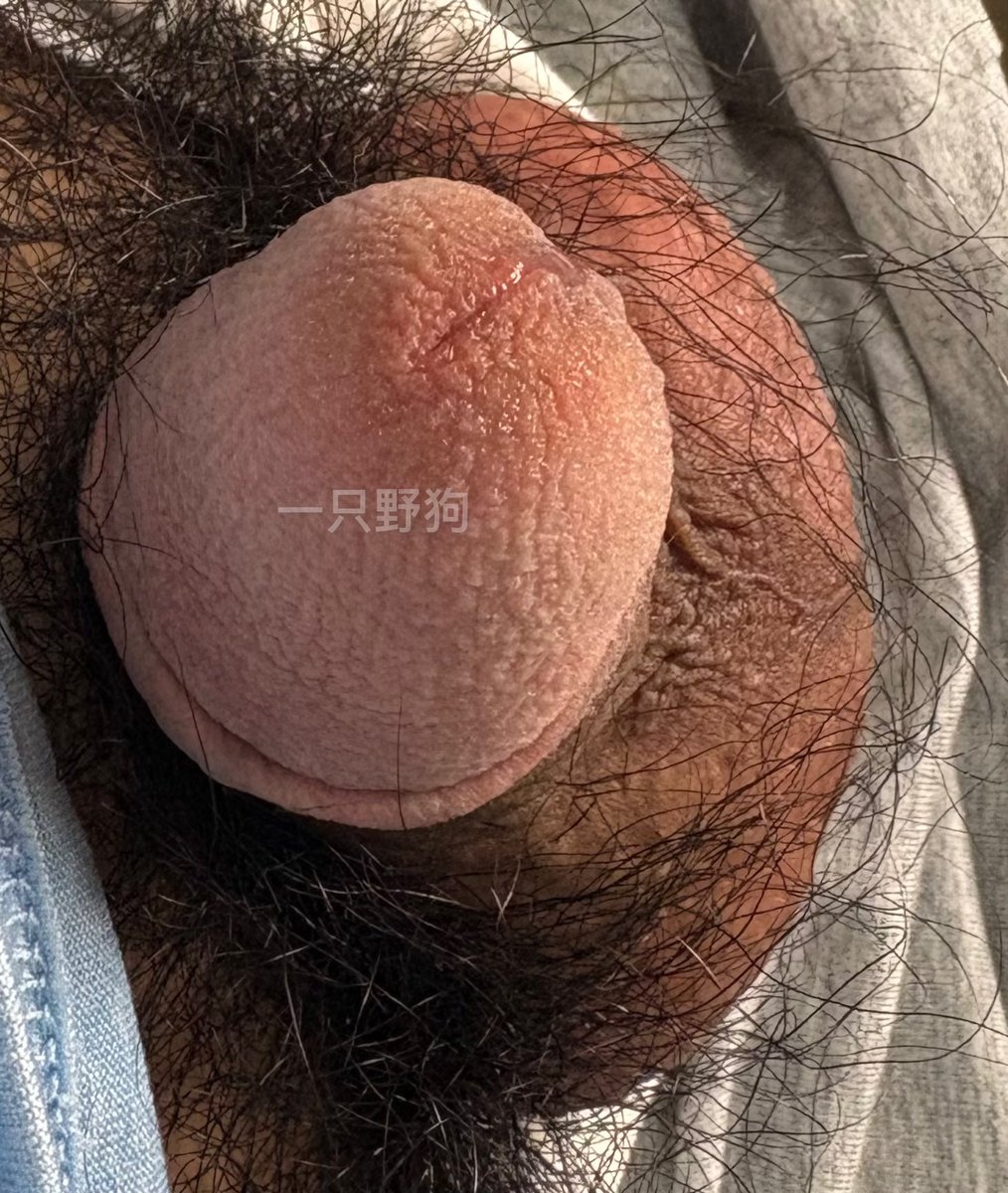 一只野狗(戴锁中) tweet media