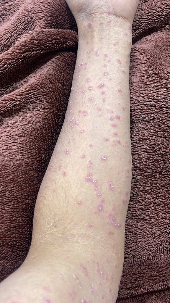 Dr.Haitham Hamoud | د.هيثم tweet media