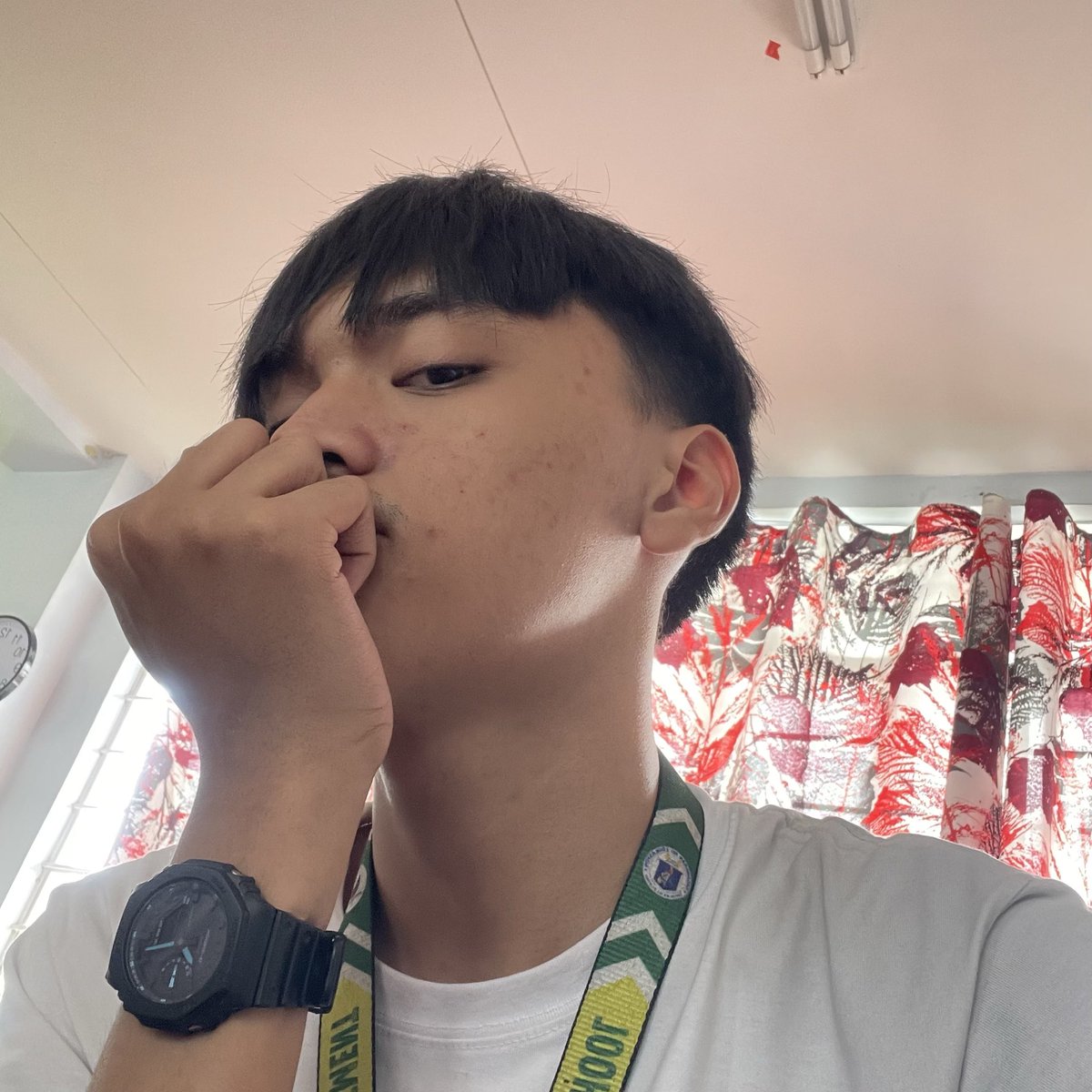 cedar_liameee's tweet photo. need ko na ata magpaderma https://t.co/Ld2alM7eYH