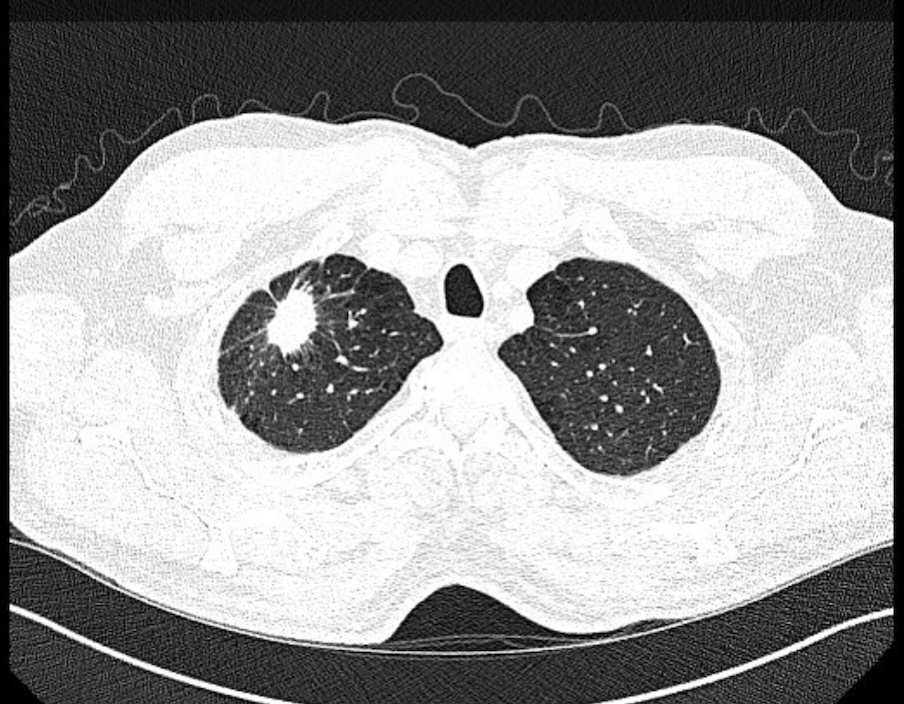 GS_Bronch tweet media