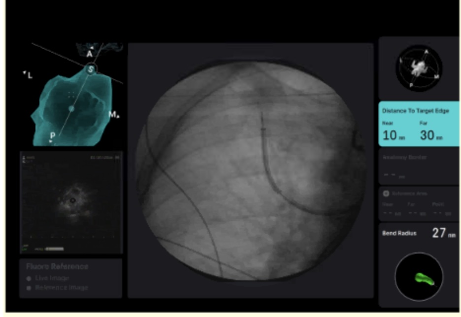 GS_Bronch tweet media