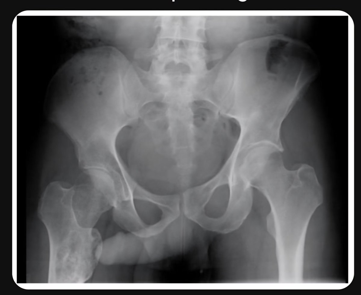 Chema 💪👍🌞 tweet media