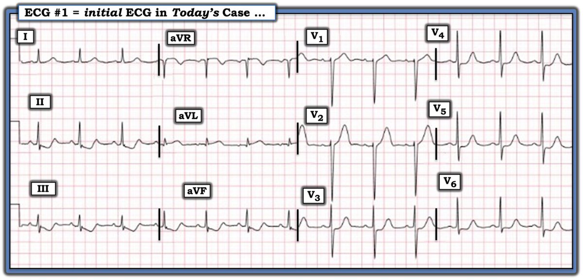 Ken Grauer, MD tweet media
