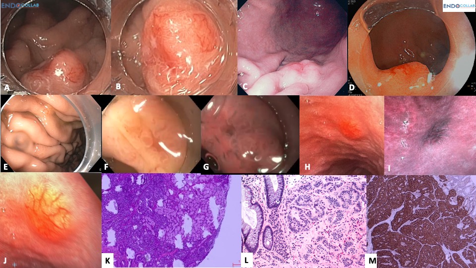 EndoCollab™ | GI Endoscopy Community tweet media