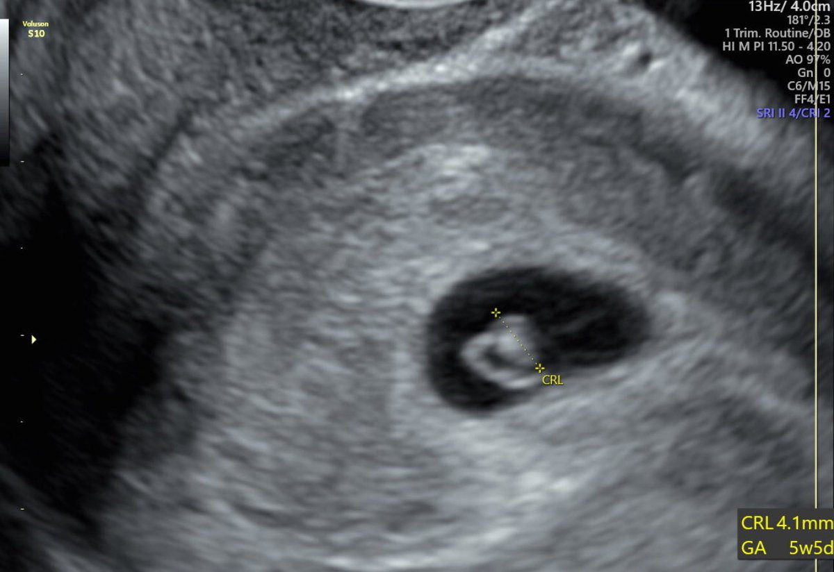 Mike Sexton tweet media