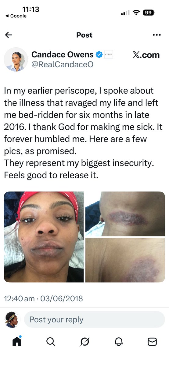 Ashlyn 🇦🇬 tweet media