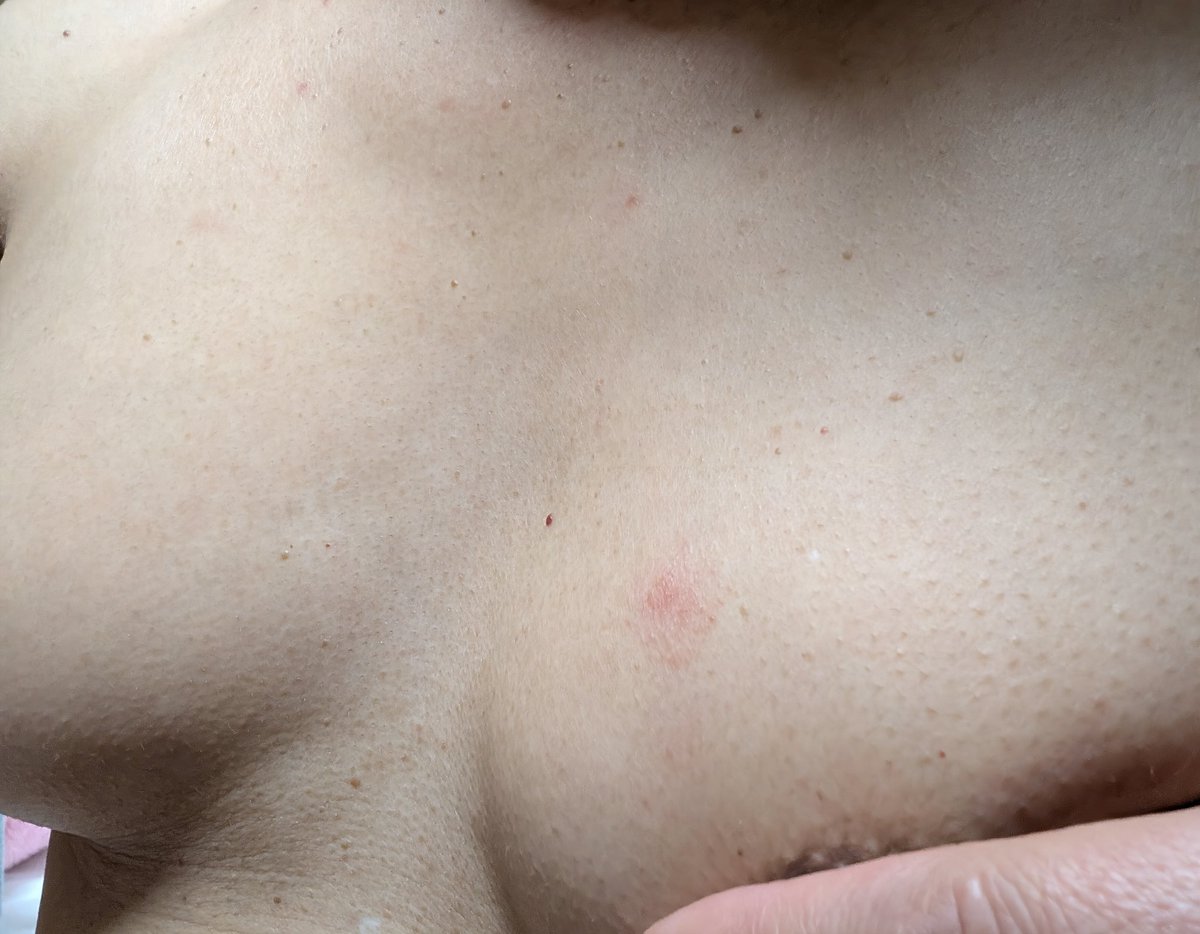 オシリーナHiromi🍑 tweet media