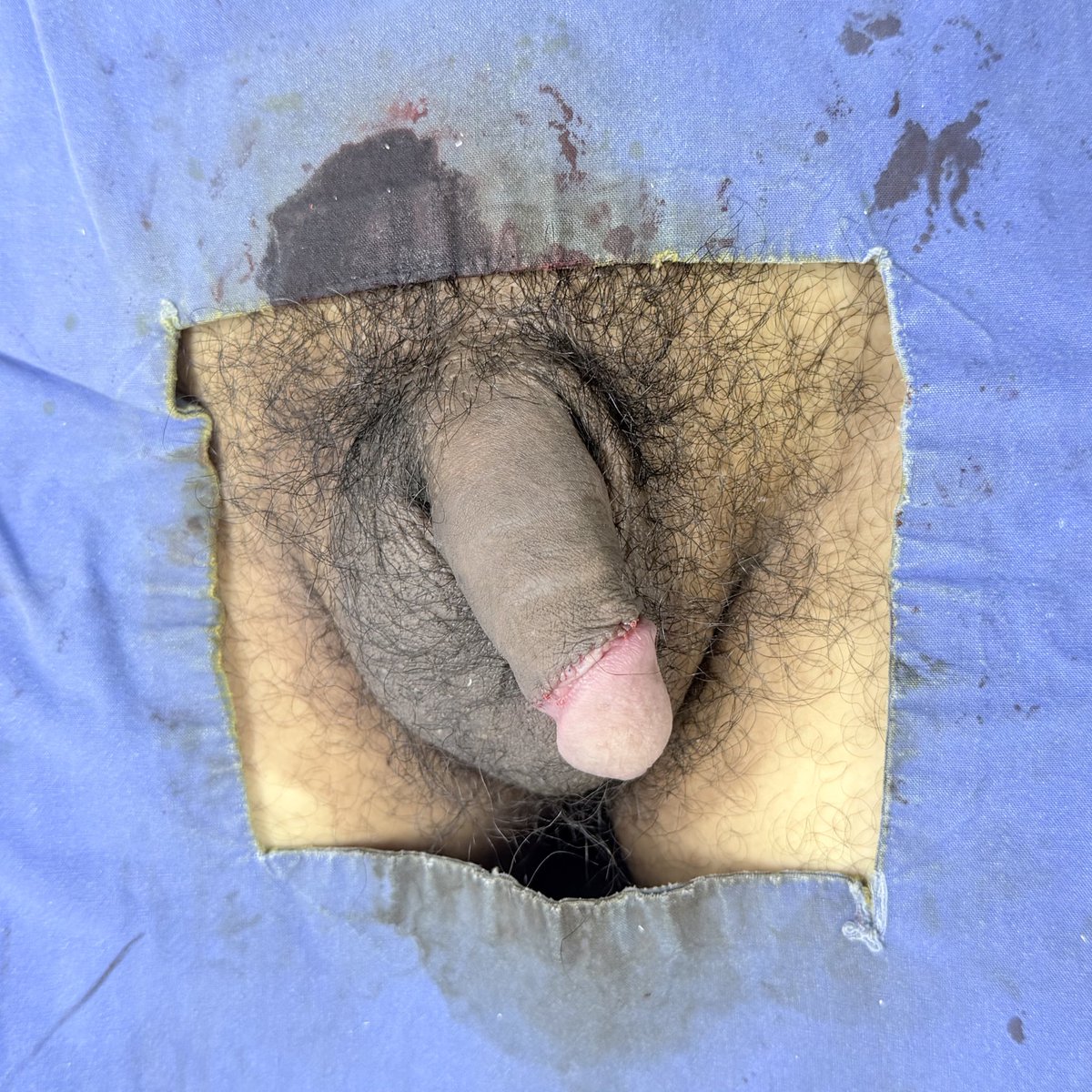 Men Plus By Mediprime Clinic tweet media