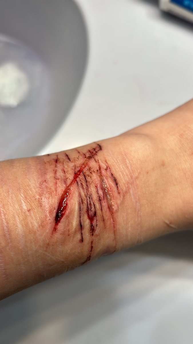 Mutilator69's tweet photo. doesnt that look so yummy?
fake!!
#shhhhhtwt #ow #ouch https://t.co/XNmzjTGlF3