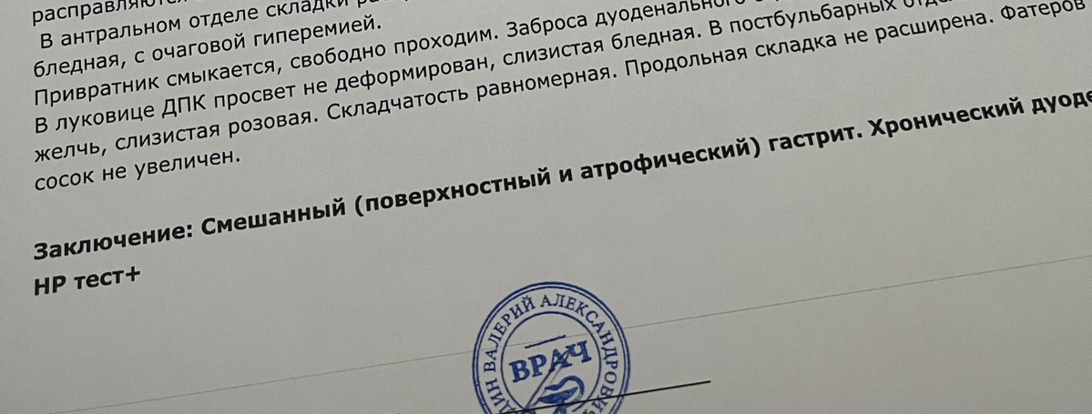 я теперь официально пережила хоррор-ивент под названием «ФГДС без анестезии» 😭