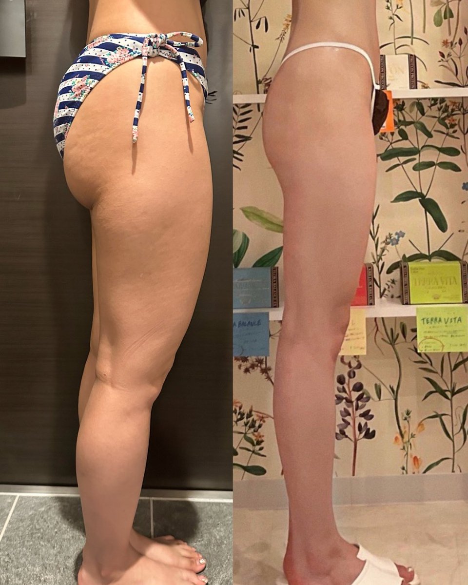 𝑴𝒂𝒚𝒖 ｜ エステティシャン tweet media