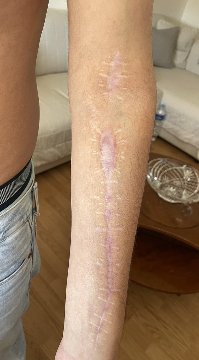 The Ghost.HL🇦🇱 tweet media