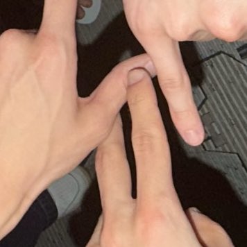 손가락을 왜 꼬집고 있지요