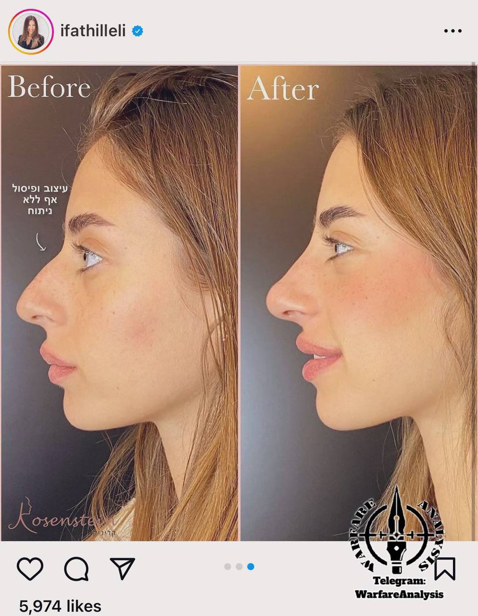 ERDLR_longlive's tweet photo. @gypsy_crus24685 @SlavicWalrus Oh I actually didn't know that. Sorry it's hard to tell after they get their nose job. https://t.co/86H0azgWXb