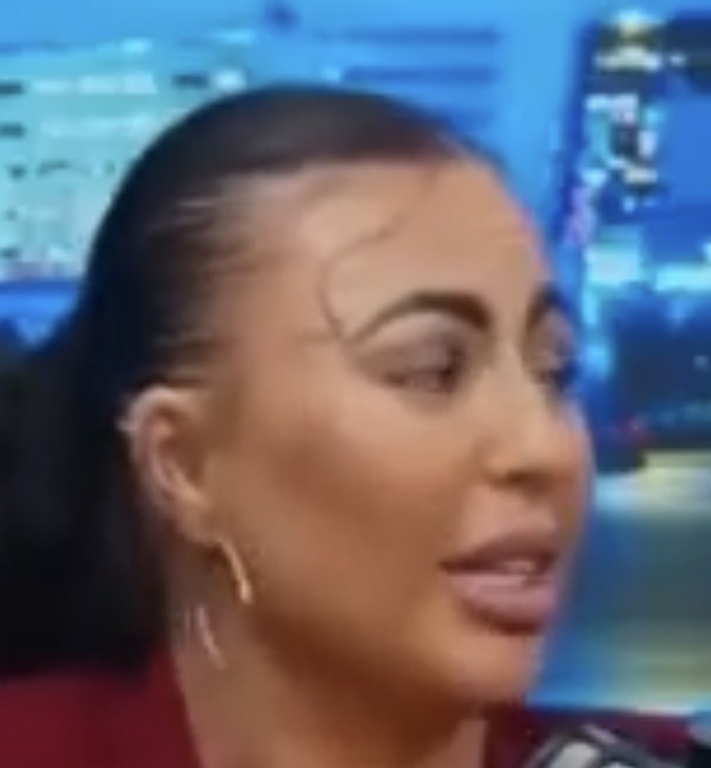 bstn_natso tweet media