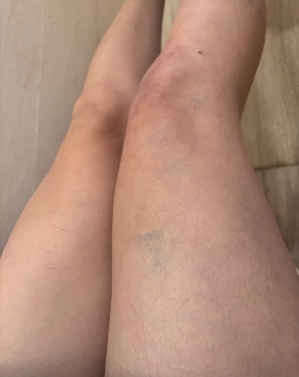 ࣪ ִֶָ☾. 𝘊𝘶𝘱𝘤𝘢𝘬𝘦⁷⊙⊝⊜ tweet media