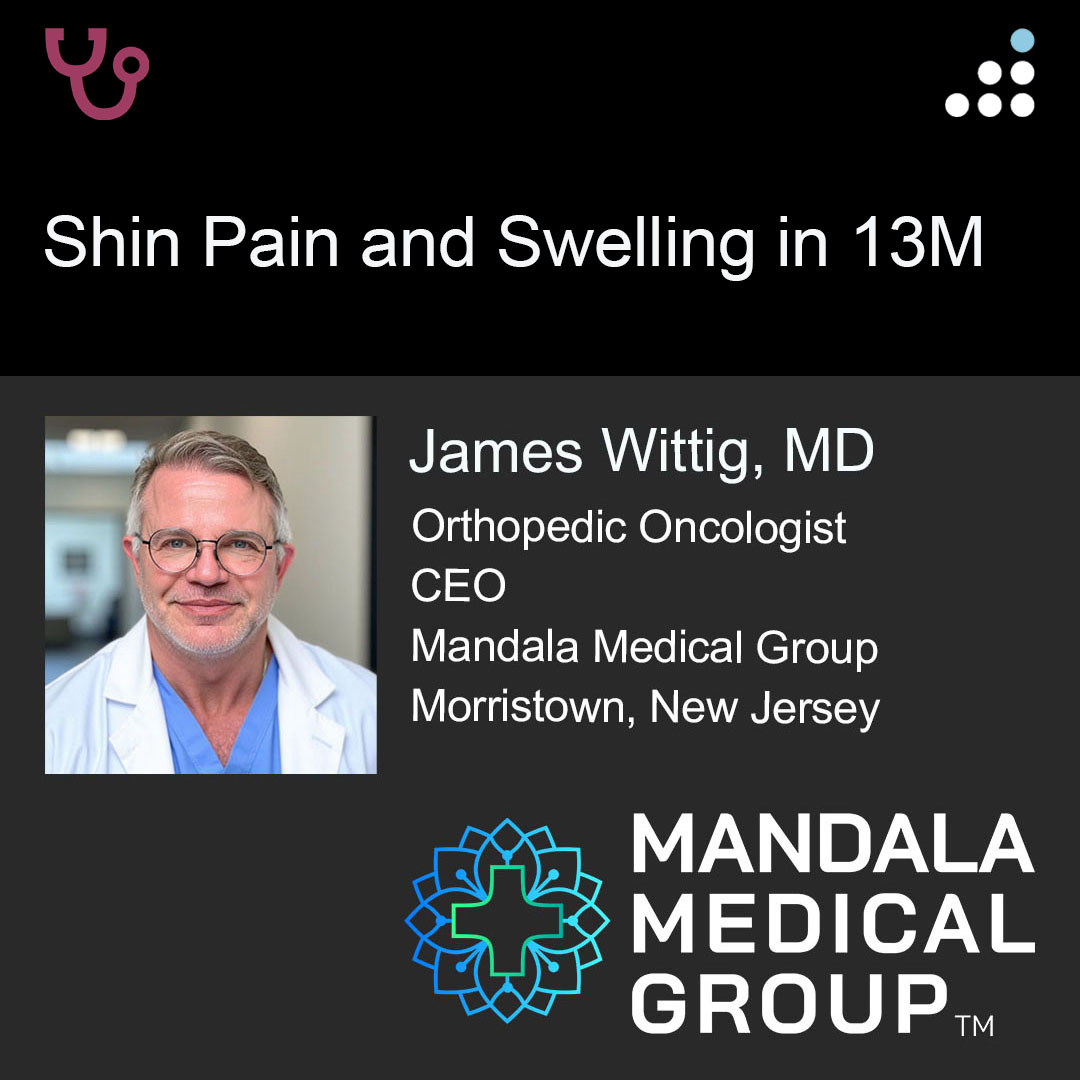 orthobullets's tweet image. Here is a new case by @DrJamesWittig and Mandala Medical Group.

SHIN PAIN AND SWELLING IN 13M

How would you manage this #orthotwitter?

Vote on this case for CME: orthobullets.tiny.us/2s3nbkwx