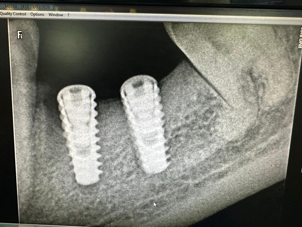 abhimanyu.eth | Epoch (Mainnet Arc) 🦇🔉 🛡️ tweet media