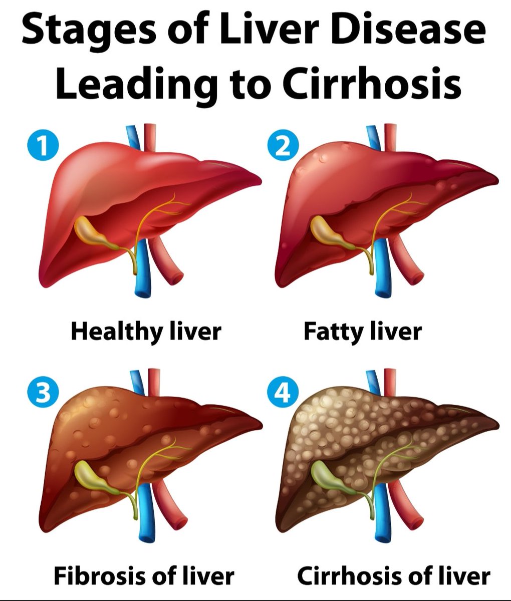 Things Nigerians Consume Daily That Are Quietly Damaging Their Organs, Biochemistry Thread 

Let’s be honest… a lot of what we eat, drink, and smoke daily isn’t as harmless as it looks.
Not everything will send you to the hospital immediately but biochemically, damage is