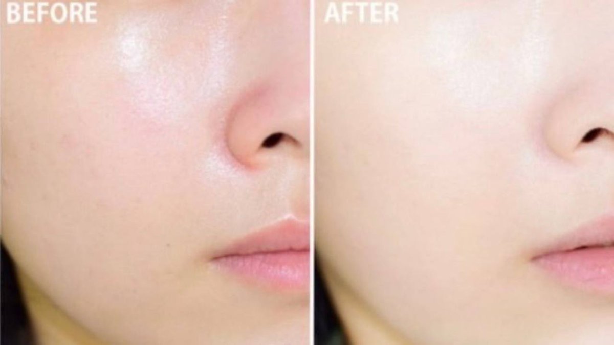 垢抜けメモちゃん tweet media