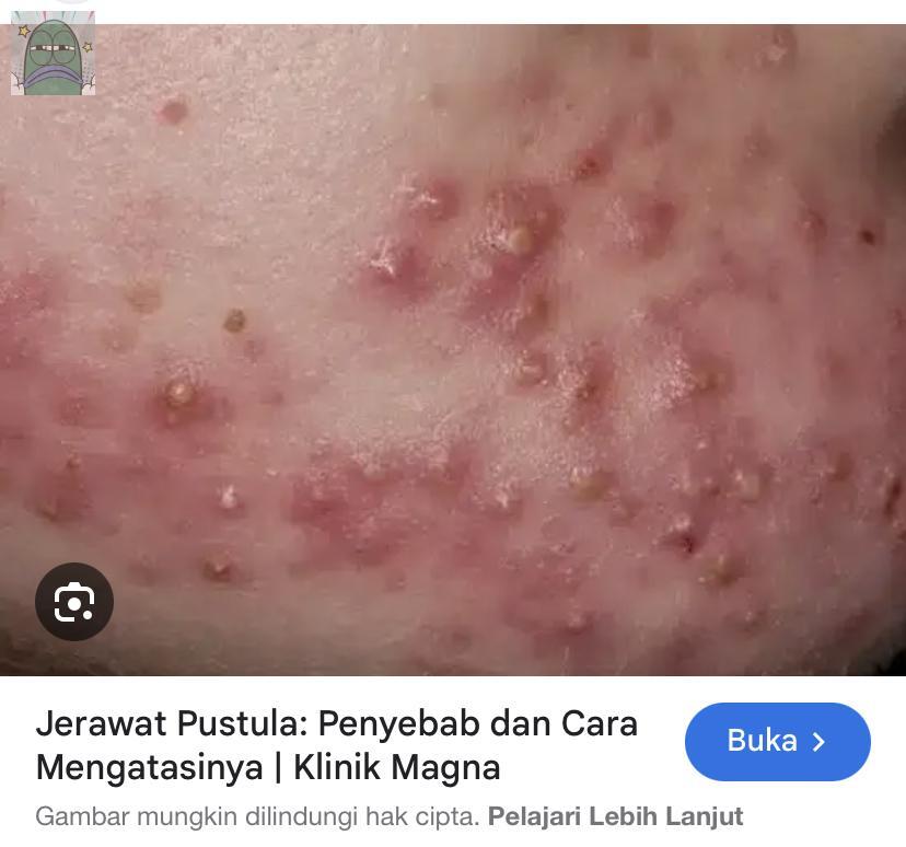 Tanyarlfes tweet media