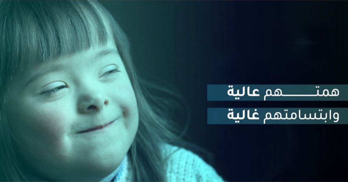 FaisalFJober's tweet photo. #اليوم_العالمي_لمتلازمه_داون

العناية بأسنان الأطفال المصابين بـ متلازمة داون 🦷:

🪥 تفريش الأسنان مرتين يوميًا بمعجون فلورايد مع إشراف الأهل، واستخدام فرشاة ناعمة أو كهربائية لتسهيل التنظيف.
🦠 عناية خاصة باللثة: استخدام الخيط يوميًا (بمساعدة)، لأنهم أكثر عرضة لالتهاب اللثة وأمراضها المبكرة.
💧 معالجة جفاف الفم عبر شرب الماء وتشجيع التنفس الأنفي إن أمكن.
🍎 تقليل السكريات والوجبات الخفيفة المتكررة لتقليل التسوس.
🦷 زيارات منتظمة كل 3–6 أشهر للكشف المبكر والتنظيف الاحترافي.
🛡️ استخدام الفلورايد ومانعات التسوس (Sealants) لحماية الأسنان.
🦷 متابعة بزوغ الأسنان وسوء الإطباق مبكرًا وتحويل لأخصائي تقويم عند الحاجة.
❤️ تقييم الحالة الطبية (خصوصًا أمراض القلب) قبل العلاج—قد يلزم مضاد حيوي وقائي.
🤝 أسلوب سلوكي مناسب: جلسات قصيرة، تدرّج، تعزيز إيجابي لزيادة التعاون.
👨‍👩‍👧 تثقيف الأهل هو الأساس: المتابعة اليومية هي العامل الأهم لنجاح الوقاية.