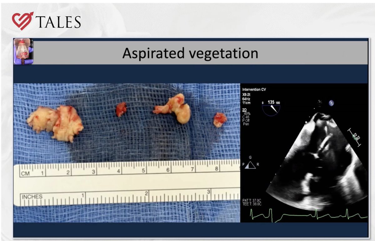 Edward J Schloss MD tweet media