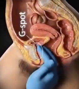 TheoFlipLife tweet media