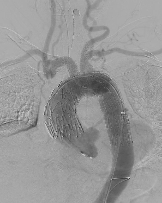 UMassVascular tweet media