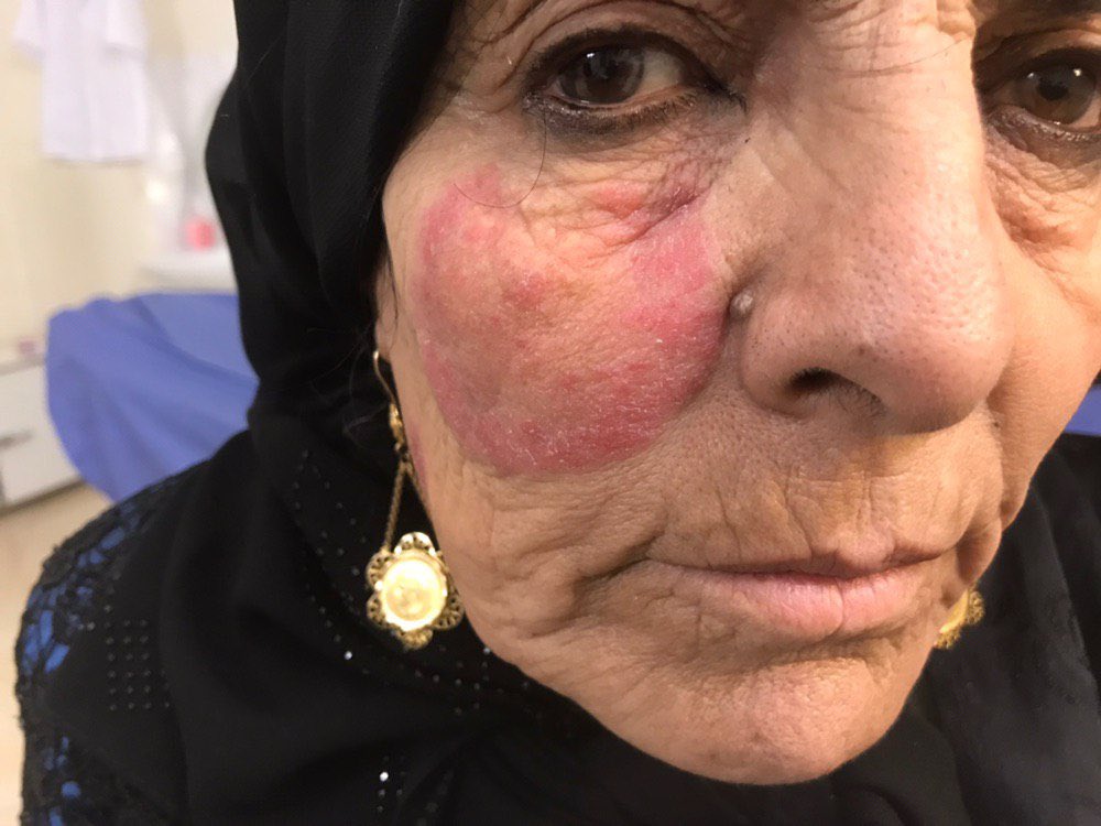 Dr.Haitham Hamoud | د.هيثم tweet media