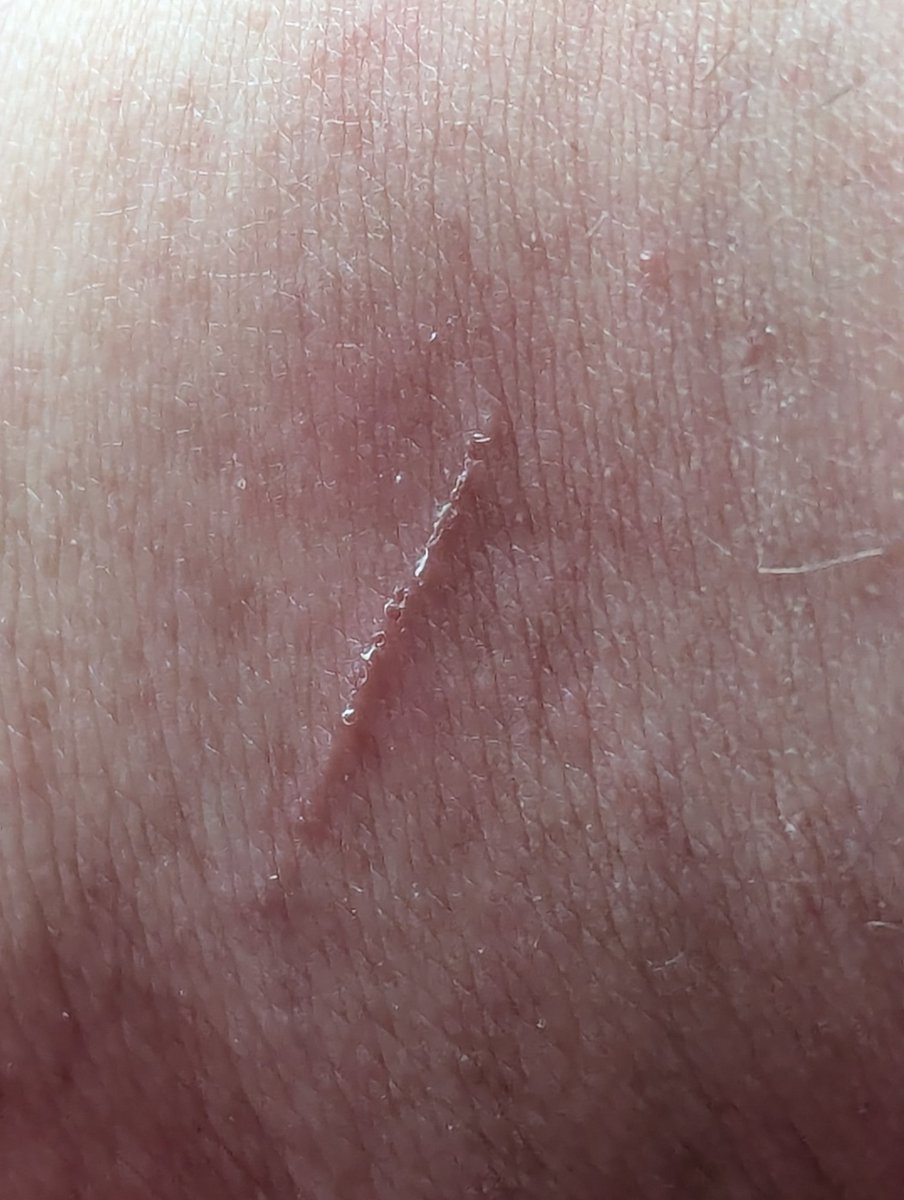 MochieVT tweet media