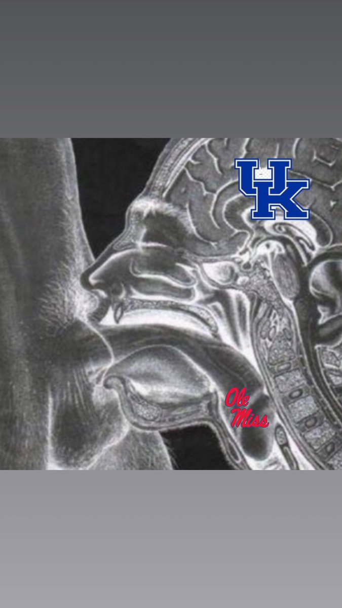 cali🇹🇹 tweet media